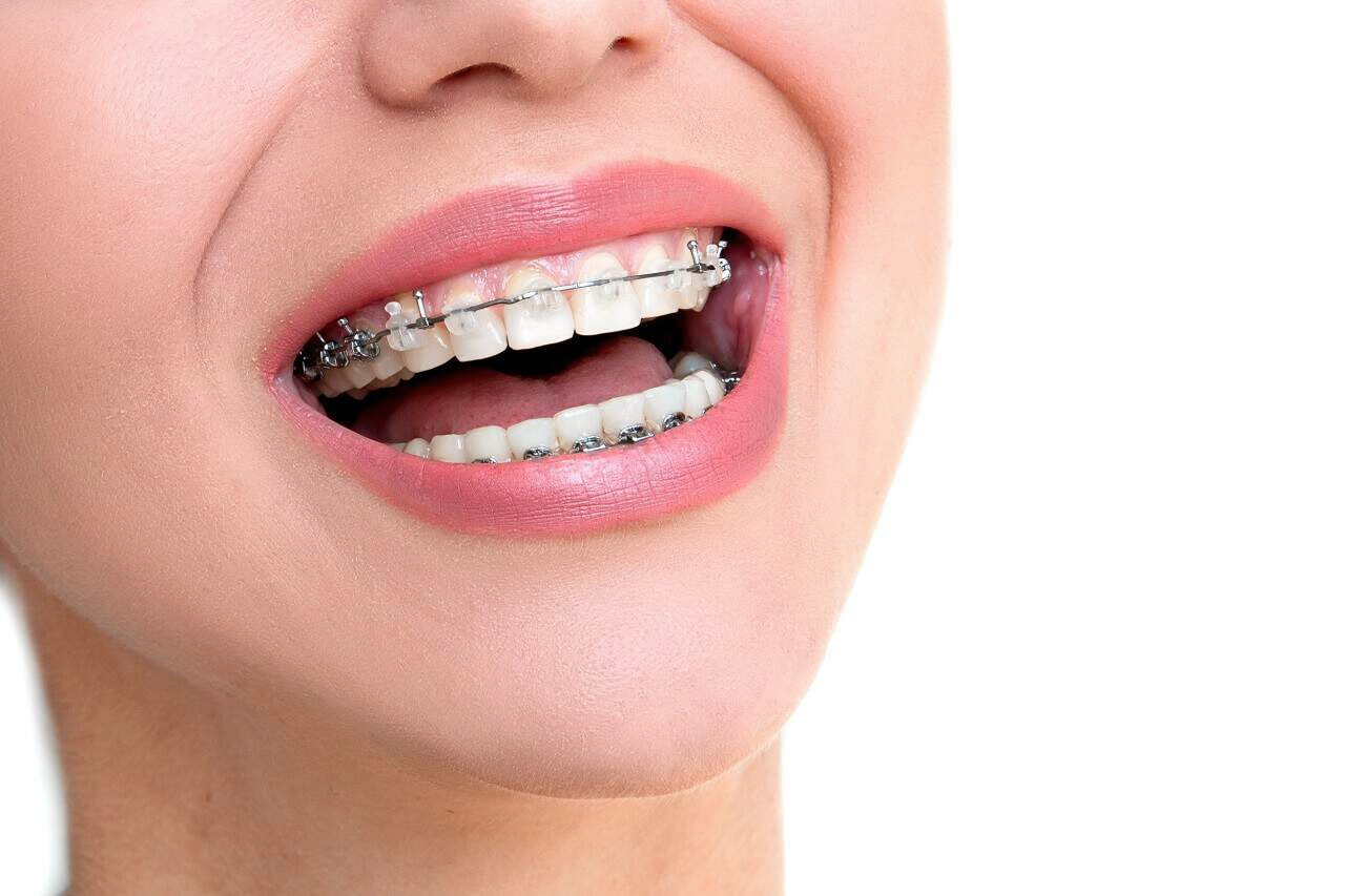 Thiết Kế Chưa Có Tên (12)
